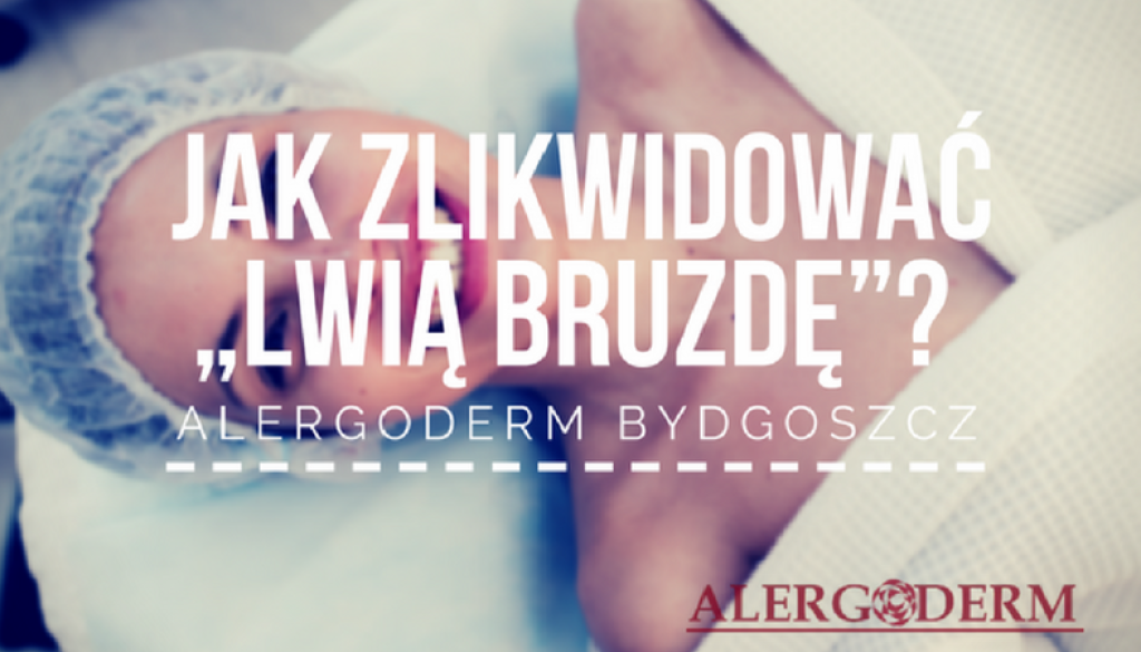 lwia-bruzda