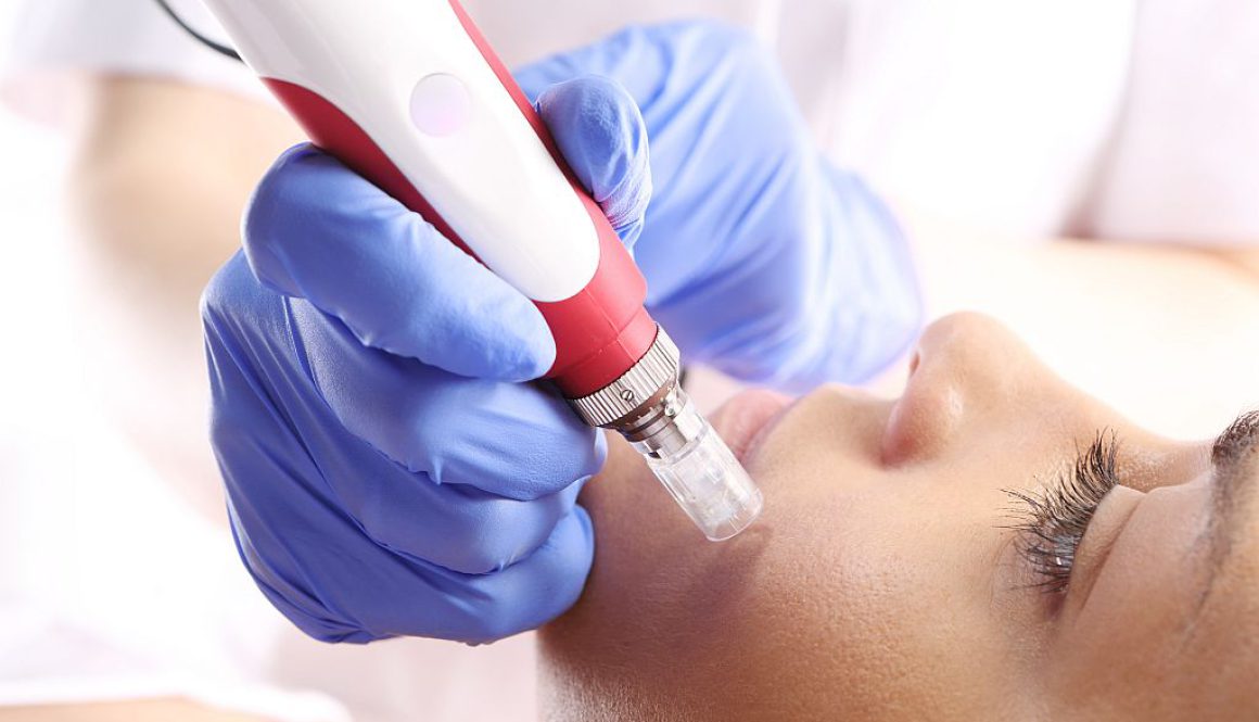 Mezoterapia igłowa – dlaczego to filar profilaktyki przeciwstarzeniowej skóry?