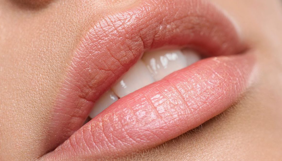 Nawilżanie ust Bydgoszcz – delikatny kwas hialuronowy Lips Soft