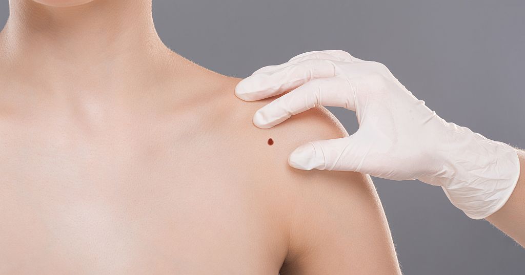 Dermatolog Bydgoszcz Prywatnie