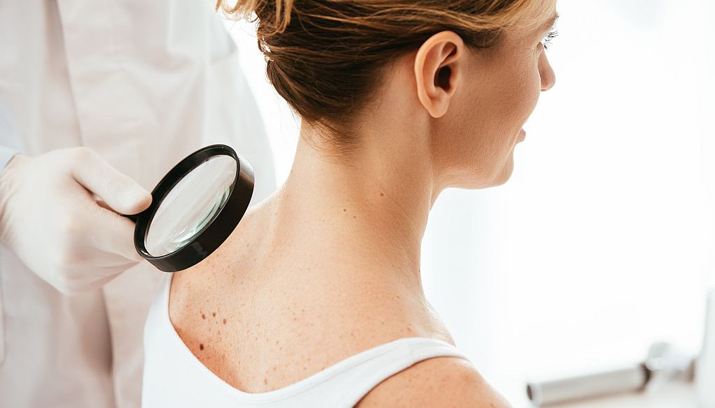 7 objawów, z którymi warto zgłosić się do dermatologa - poradnik dla pacjentów z Bydgoszczy