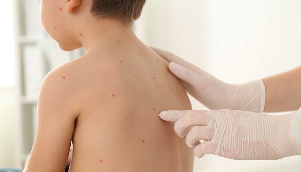 Dermatolog dla dziecka od 7. roku życia