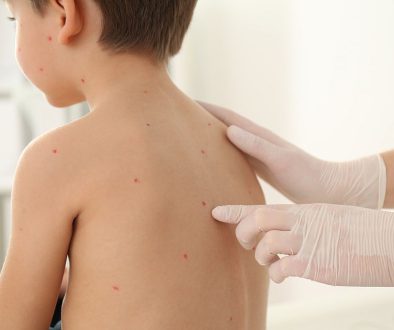 Dermatolog dla dziecka od 7. roku życia