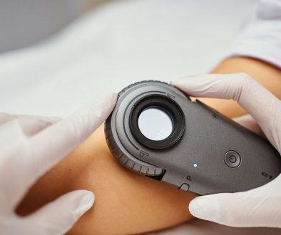 Jak obserwować znamiona między wizytami i kiedy zgłosić się na dermatoskopię