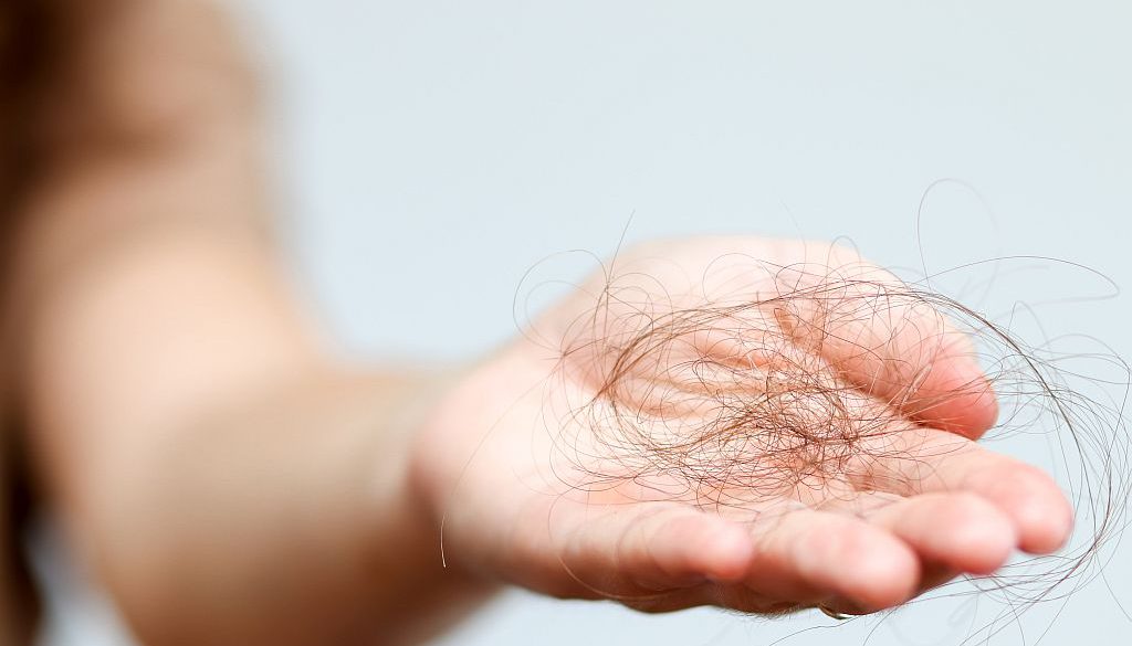 Nadmierne wypadanie włosów