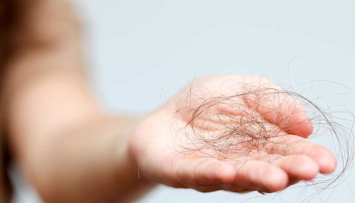 Nadmierne wypadanie włosów