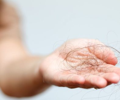 Nadmierne wypadanie włosów