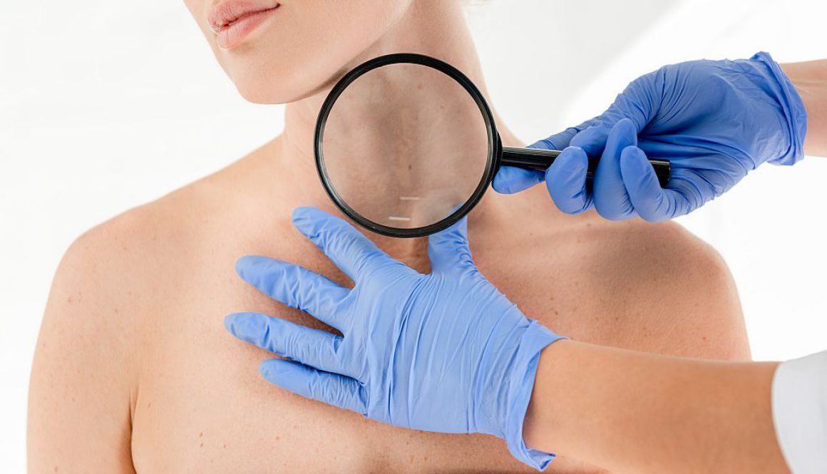 Pierwsza wizyta u dermatologa