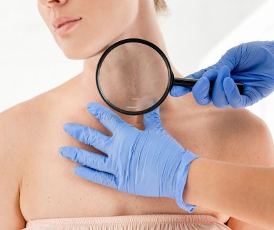 Pierwsza wizyta u dermatologa